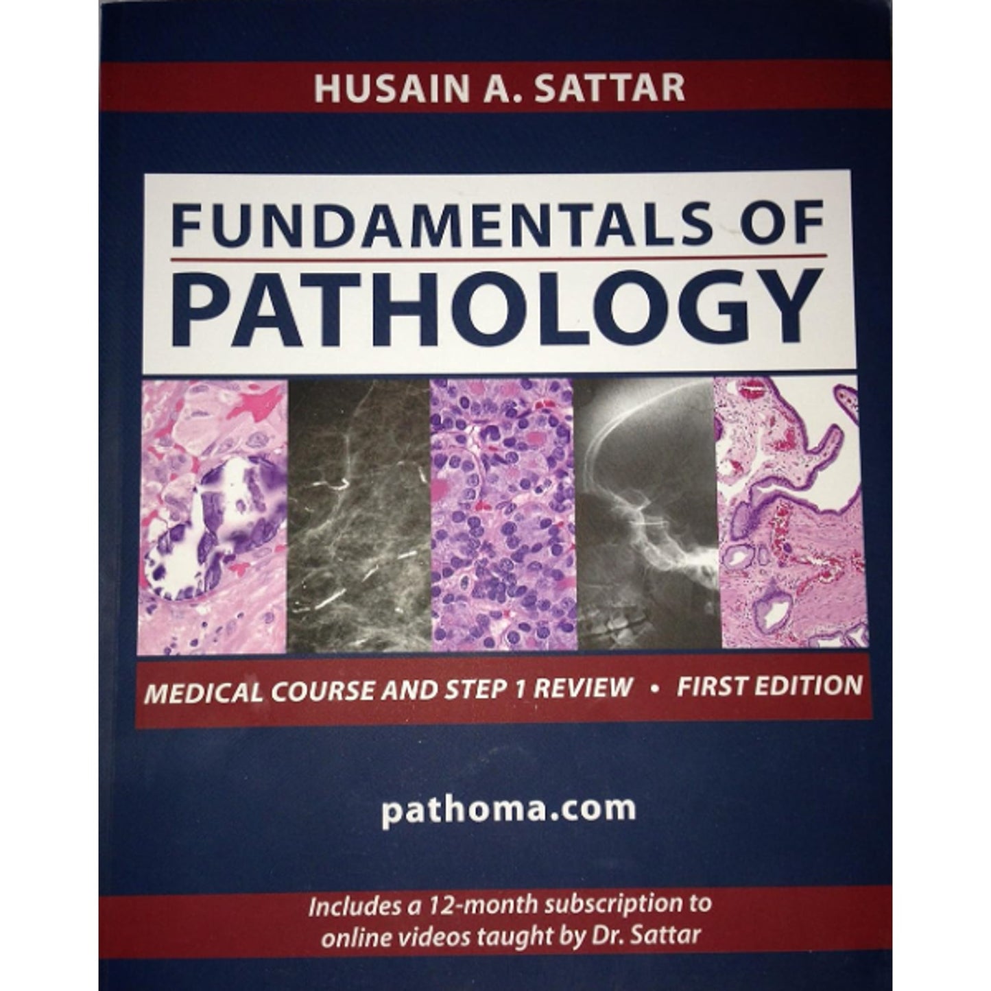 Fundamentals of Pathology - Paperback, by Husain A. Sattar